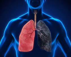 Don't delay in getting lung problems diagnosed by a doctor if you have any serious symptoms. Lung Cancer Diagnosis Portland Cancerous Tumors Oregon City