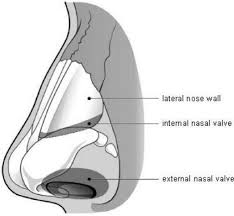 Want to learn more about it? Nasal Valve Collapse Head And Neck Surgeon