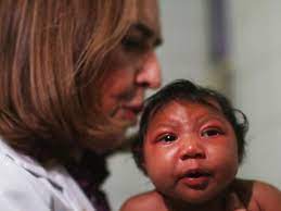 Es gibt einen zusammenhang von zika virus infektionen mit schweren missbildungen während der. Kinderwunsch Darum Solltest Du Aufgrund Des Zika Virus 6 Monate Keinen Sex Haben Wunderweib