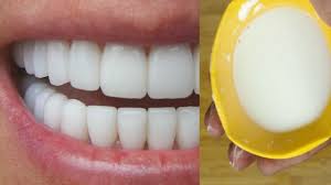 De la acest nivel pleaca venele pulmonare care vor iesi din plaman prin hil si se duc spre atriul stang. Ghimbirul Elimina Mucusul Din Plamani Intr O Singura Noapte Si Vindeca Tusea Youtube