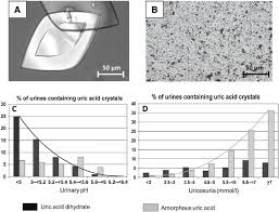 The ph of urine can be determined during a urine test and this particular urine test can also be performed at home. Crystalluria