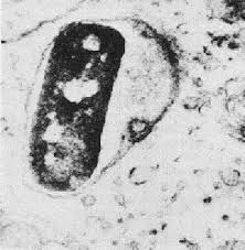 Image result for Shigella