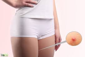 One of the main cause these stubborn inward growing hairs in this region is friction. How To Get Rid Of Boils On Inner Thigh Top 10 Home Remedies