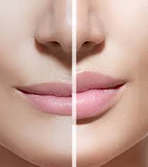 We did not find results for: Lip Fillers Adelaide Face And Body Cosmetic Clinic