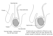 Image result