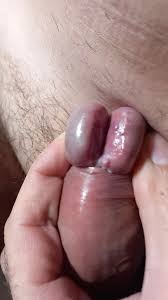 Rule34- Lara Croft's split glans- 8076662