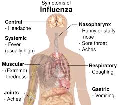 Image result for Influenza