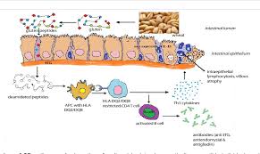 A type of 3 indicates symptomatic celiac. Development Of Celiac Disease Pathogenesis And Strategies To Control A Molecular Approach Semantic Scholar