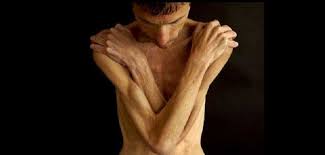 Are you Underweight? Tips to put on some weight