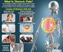 The diagnosis of thoracic disc syndrome requires a high index of suspicion and should be considered in patients with chronic abdominal pain. Thoracic Pain Treatment Causes Symptoms Diagnosis