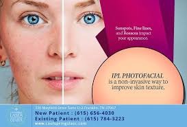 At franklin skin and laser is a medical practice in franklin tennessee, that specializes in cosmetic dermatology and aesthetic surgery on the face, body, . To Schedule Your Ipl Photofacial Consultation Call 615 656 4030 Ipl Photofacial Improve Skin Texture Photofacial