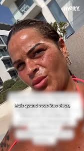 Sarah Fraisou s'expose sans crème solaire et ça fait polémique 🤯