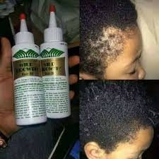 It is a comprehensive approach that requires the blood, cells and tissue that support scalp and protein synthesis to be considered and. Facebook