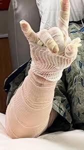 Pray for @JordanShipley8 for a full and speedy recovery... 🙏🤘, Son of the  King ✝️, Husband, Rancher..., Former College & @NFL WR..., He was badly  burned in a ranch equipment accident and has a tough ...