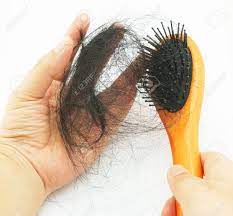 Theradome pro lh80 laser comb is a device that prevents hair loss with its embedded laser. Many Hair Fall Out Of Your Head After Combing Hair Stock Photo Picture And Royalty Free Image Image 30809142