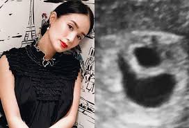 Her birthday, what she did before fame, her family life, fun trivia facts, popularity rankings, and more. Heart Evangelista Loses Remaining Baby Philstar Com