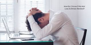 Unlike alopecia areata, telogen effluvium is most often characterized by a if you think you might be experiencing hair loss due to stress, it's time to see your doctor or a dermatologist who can help rule out other causes. How Do I Know If My Hair Loss Is Stress Related Njhrc Blog