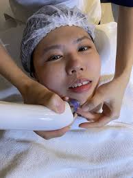 part 02] My IDS Journey with IDS Aesthetics