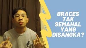 Serahkan pesanan kerajaan yang telah ditandatangani oleh pembekal bersama invois dan senarai nama peserta yang bertandatangan (jika berkenaan) ke unit kewangan. Harga Braces 8 Dubai Khalifa