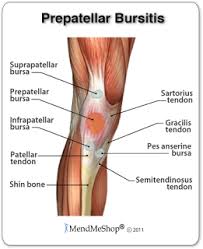 The Morning Runner Beating Bursitis Bursitis Knee Knee Tendonitis Bursitis Treatment