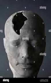 Crâne brisé brisé Banque de photographies et d'images à haute résolution