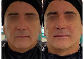 Clínica Dra. Azcárate