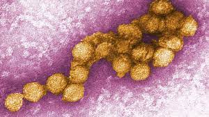 West nile virus (virus) causes et facteurs aggravants  modifier  tout contexte d'instabilité écologique, paysagère, environnementale ou sociale (guerre, déplacements de réfugiés, appauvrissement de populations, etc.) peut favoriser une maladie émergente ou sa diffusion. West Nil Virus Erreicht Deutschland Die Falle Werden Bei Sehr Heissen Sommern Zunehmen Stern De