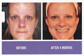 Anti-aging Products Billings MT