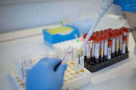 Laborator de analize medicale, analize de microbiologie. Laborator De Analize Spitalului ProvidenÈa ProvidenÈa PoliclinicÄ Èi Spital