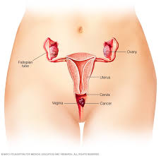 The cancer might invade other tissues and organs. Vaginal Cancer Symptoms And Causes Mayo Clinic