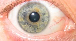 34 studious iridology chart brown around pupil