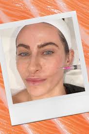 I Got a Salmon Sperm Facial—And Id Do It Again | Allure