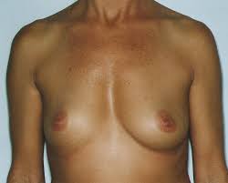 Nude Breast Size Comparison Chart