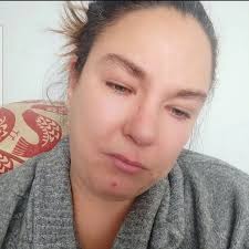 Cork woman with chronic pain has €5 a week to live