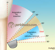 Periodontal Instruments Periobasics Com