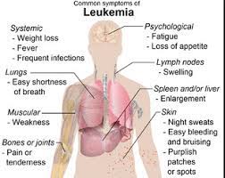 Blood cancer symptoms and signs. Warning Signs Of Leukemia And Other Blood Cancers
