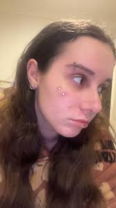 does anyone have any pictures of healed angel fang scars? i love them so so  much but i think one of mine might be rejecting :(( and im a little nervous  what