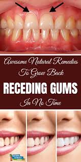 Recedinggums Recedinggumsremedies Growbackrecedinggums Recedinggumshomeremedy Receding Gums Reced Receding Gums Natural Oral Care Grow Back Receding Gums
