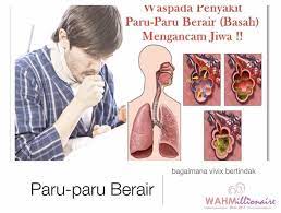 Contextual translation of menghidapi penyakit paru paru berair into english. Ag Cera Paru Paru Berair Atau Juga Dikenali Facebook