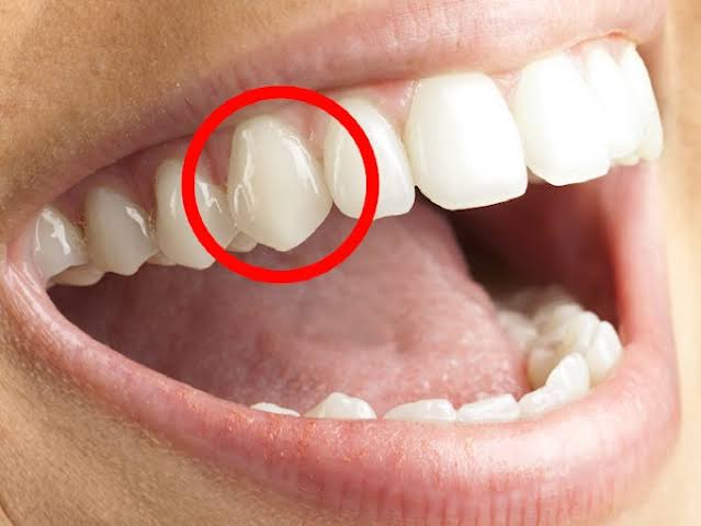 Sharp carnivore teeth