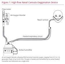Nasal cannula nasal oxygen cannula medical hfnc high flow oxygen nasal cannula. One Party Violetta Nasal Cannula O2 Rate Effect Of High Flow Nasal Cannula Versus Conventional Oxygen Therapy For Patients With Thoracoscopic Lobectomy After Extubation Yes It Does In Many Ways Such As