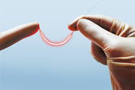 Image result for Porfimer