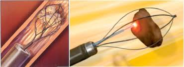 Urology Waikato