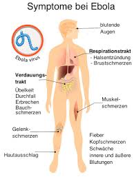 The first symptoms are usually fever, sore throat, muscle pain, and headaches. Ebola Virus Einfach Und Verstandlich Erklart Von Thomas Schnura