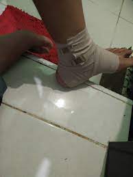 Ketika seseorang ini tengah mengalami patah tulang akan merasa sangat mengganggu. Verban Elastis 3 In Elastic Bandage 3 Inch Verban Pembalut Patah Tulang 3 Inci 3 Perban Elastis 3 In Verban Elastis 3in Verban Elastis 3inci Verban Elastis 3inch Perban Patah Tulang 3inchi