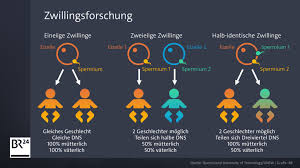 Auch wenn zum beispiel das dresden komisch klingt, hat es das alte dresden bis zu einem buchtitel geschafft. Wunder Der Natur Eineiige Zwillinge Mit Verschiedenem Geschlecht Es Sind Zwei