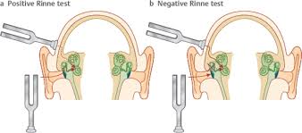 Image result for Tuning Fork Test