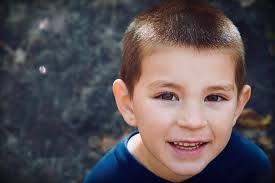 Are 'gold' eyes an anomaly, or fairly normal?