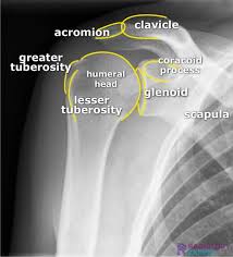 Image result for Shoulder XRay