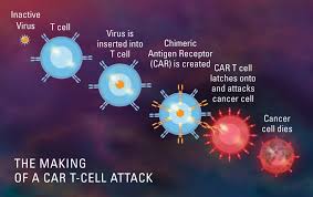 However, this is not always true. From Recurrence To Remission Lymphoma Patient Is Cancer Free After Car T Cell Therapy Dana Farber Cancer Institute